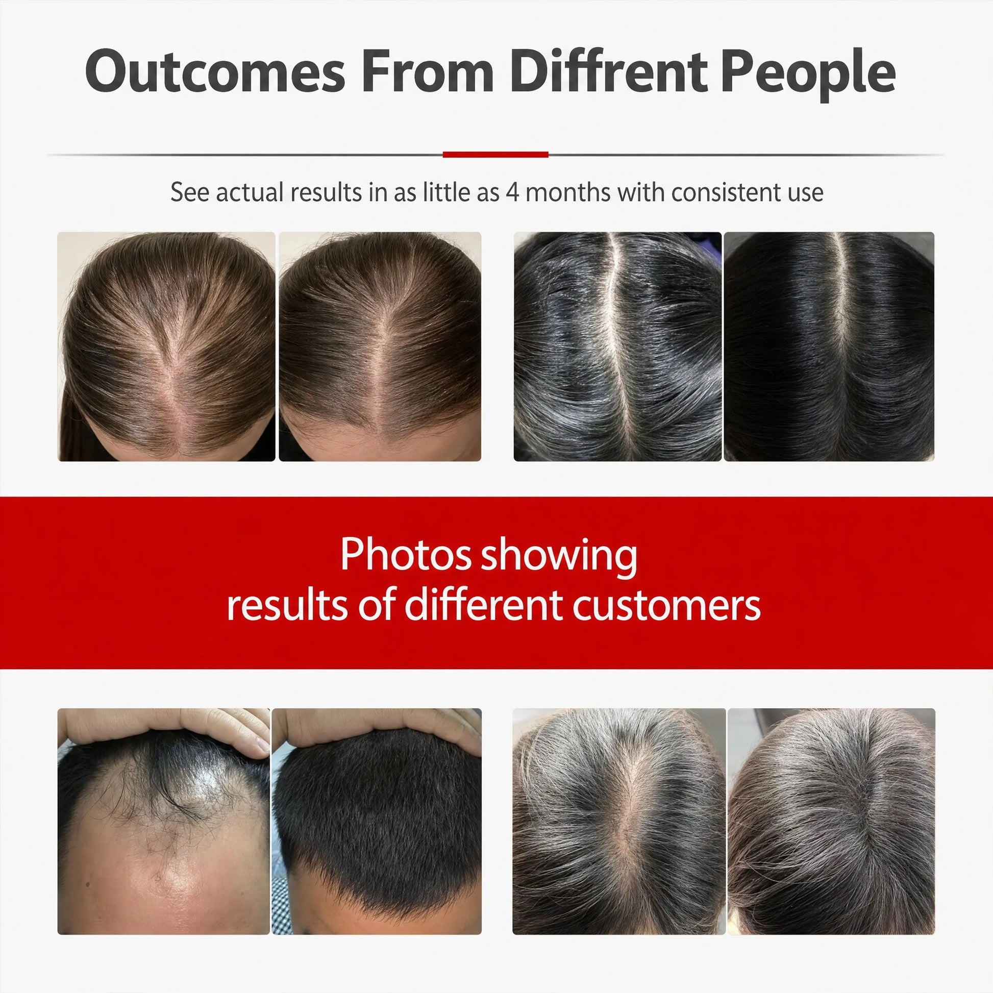 Red Light Hair Growth Cap Infrared anti Hair Loss Therapy Device Helps Reduce Hair Loss and Improve Scalp Blood Circulation